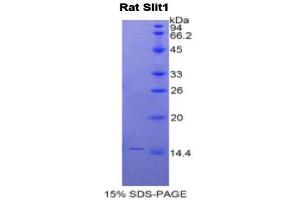 SDS-PAGE (SDS) image for Slit Homolog 1 (SLIT1) (AA 3-112) protein (His tag) (ABIN2122114) (SLIT1 Protein (AA 3-112) (His tag))