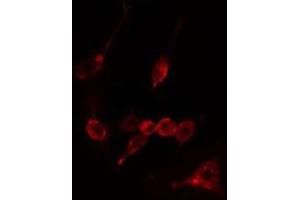 ABIN6274937 staining LOVO cells by IF/ICC. (CAPN10 抗体  (N-Term))