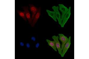 ABIN6256983 and ABIN6274937 staining Hela cells by IF/ICC. (CAPN10 抗体  (N-Term))
