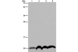 Western Blot analysis of SKOV3 cell and Human fetal liver tissue, Human fetal brain tissue and Hela cell using NDUFA4 Polyclonal Antibody at dilution of 1:300 (NDUFA4 抗体)