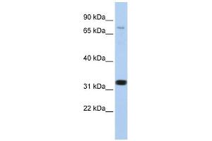 CACNB2 antibody used at 1 ug/ml to detect target protein. (CACNB2 抗体  (N-Term))