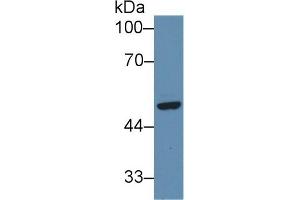 Detection of SFRP4 in Human Hela cell lysate using Polyclonal Antibody to Secreted Frizzled Related Protein 4 (SFRP4) (SFRP4 抗体  (AA 265-346))