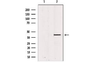 Western blot analysis of extracts from rat brain, using PSAT1 antibody. (PSAT1 抗体  (Internal Region))