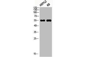 Western Blot analysis of HEPG2 KB using Phospho-Akt1 (S246) Polyclonal Antibody (AKT1 抗体  (pSer246))