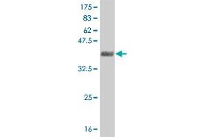 Western Blot detection against Immunogen (37. (GSC 抗体  (AA 78-186))