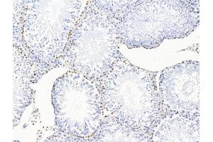 ABIN7094735 and ABIN7098786 at 1/100 staining Rat testis tissue by IHC-P. (POLQ 抗体  (Internal Region))