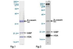 Kinase Activity Assay (KAA) image for Eukaryotic Elongation Factor-2 Kinase (EEF2K) (AA 1-725) protein (GST tag) (ABIN1352365) (EEF2K Protein (AA 1-725) (GST tag))