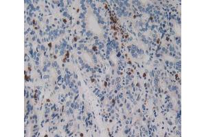 Used in DAB staining on fromalin fixed paraffin- embedded stomach cancer tissue (Netrin 4 抗体  (AA 349-592))
