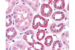 Immunohistochemistry (IHC) image for anti-HNF1 Homeobox A (HNF1A) (N-Term) antibody (ABIN2784536) (HNF1A 抗体  (N-Term))
