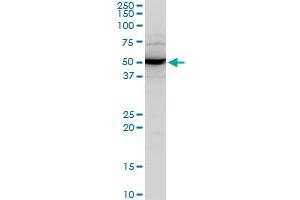 ABHD5 polyclonal antibody (A02), Lot # 060103JC01. (ABHD5 抗体  (AA 240-342))