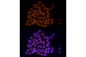 Immunofluorescence analysis of HeLa cells using TCE Rabbit mAb (ABIN7270877) at dilution of 1:25 (40x lens).