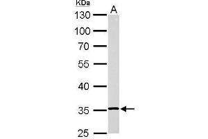 Western Blotting (WB) image for anti-Ribosomal Protein L5 (RPL5) antibody (ABIN2855187)