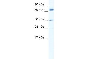 WB Suggested Anti-ALX3 Antibody Titration:  2. (ALX3 抗体  (N-Term))