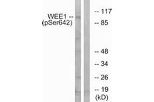 Western blot analysis of extracts from 293 cells treated with etoposide 25uM 60', using WEE1 (Phospho-Ser642) Antibody. (WEE1 抗体  (pSer642))