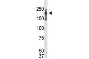 PRDM2 抗体  (AA 1-347)