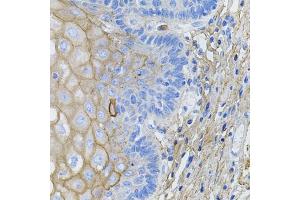 Immunohistochemistry of paraffin-embedded human esophagus using COL1A1 antibody. (COL1A1 抗体)