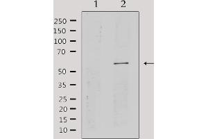 Western blot analysis of extracts from HepG2, using Cytochrome P450 2A13 Antibody.
