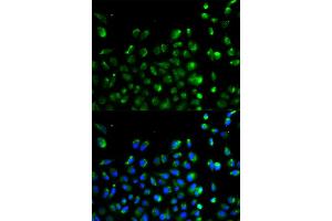 Immunofluorescence analysis of A549 cells using ATG13 antibody (ABIN5970264). (ATG13 抗体)
