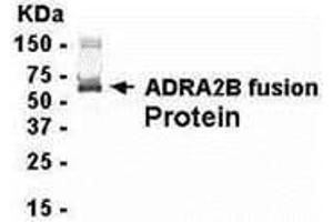 Western Blotting (WB) image for anti-Adrenergic, alpha-2B-, Receptor (ADRA2B) (AA 200-299) antibody (ABIN2467937) (ADRA2B 抗体  (AA 200-299))