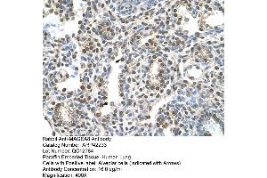 Rabbit Anti-MAGEA8 Antibody  Paraffin Embedded Tissue: Human Lung Cellular Data: Alveolar cells Antibody Concentration: 4.