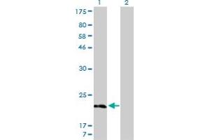 Western Blot analysis of MYL5 expression in transfected 293T cell line by MYL5 monoclonal antibody (M01), clone 1C5.