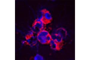 Staining of a cytospin preparation of peripheral blood mononuclear cells (PBMC) isolated from buffycoat. (Cathelicidin 抗体)