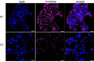 Immunocytochemical staining of HeLa cells using Prohibitin antibody (ABIN7799910), 1:1,000), Top panel: wild-type (WT), Bottom panal: Prohibitin shRNA knockdown (KD). (Recombinant Prohibitin 抗体)