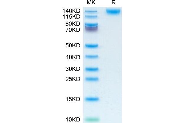 CD45 Protein (AA 26-577) (His tag)