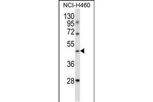 Western blot analysis in NCI-H460 cell line lysates (35ug/lane). (TLE6 抗体  (N-Term))