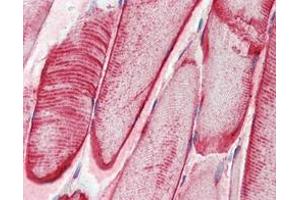 Immunohistochemical analysis of paraffin-embedded human skeletal muscle tissues using CRYAB mouse mAb. (CRYAB 抗体  (AA 1-175))