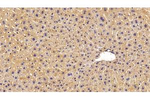 Detection of MASP1 in Mouse Liver Tissue using Polyclonal Antibody to Mannose Associated Serine Protease 1 (MASP1) (MASP1 抗体  (AA 25-453))
