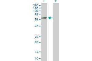 Western Blot analysis of ADAD1 expression in transfected 293T cell line by ADAD1 MaxPab polyclonal antibody. (ADAD1 抗体  (AA 1-565))