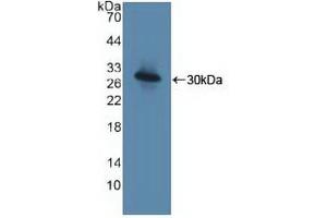 Western blot analysis of recombinant Human TICAM1. (TICAM1 抗体  (AA 443-685))