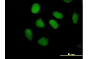 Immunofluorescence of purified MaxPab antibody to ZNF547 on HeLa cell. (ZNF547 抗体  (AA 1-402))