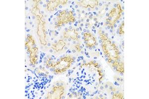 Immunohistochemistry of paraffin-embedded mouse kidney using SRPX antibody at dilution of 1:100 (x40 lens). (SRPX 抗体)