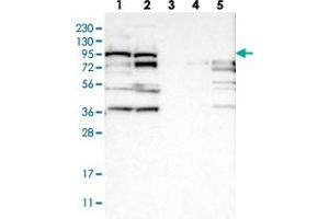 Western blot analysis of Lane 1: RT-4, Lane 2: U-251 MG, Lane 3: Human Plasma, Lane 4: Liver, Lane 5: Tonsil with RRP1B polyclonal antibody  at 1:250-1:500 dilution. (RRP1B 抗体)