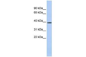 CLN6 antibody used at 1 ug/ml to detect target protein. (CLN6 抗体  (Middle Region))