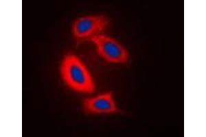 Immunofluorescent analysis of RAB31 staining in Raw264. (RAB31 抗体  (Center))
