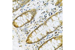 Immunohistochemistry of paraffin-embedded human colon using PGK1 Antibody (ABIN6290734) at dilution of 1:100 (40x lens). (PGK1 抗体)