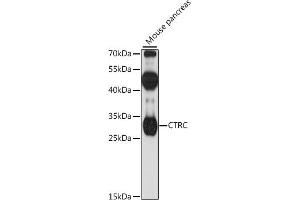 Western blot analysis of extracts of mouse pancreas, using CTRC antibody (ABIN7266396) at 1:1000 dilution. (Elastase 4 抗体  (AA 30-150))