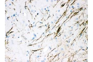 Anti- TH Picoband antibody,IHC(P) IHC(P): Mouse Brain Tissue (TH 抗体  (Middle Region))