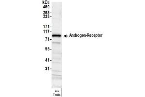 Western Blotting (WB) image for anti-Androgen Receptor (AR) (AA 1-50) antibody (ABIN7454995) (Androgen Receptor 抗体  (AA 1-50))