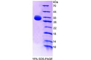 SDS-PAGE analysis of Rat SHP Protein. (NR0B2 蛋白)