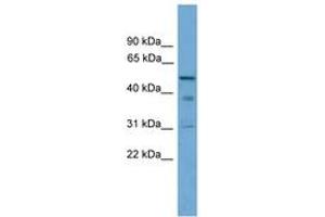 Image no. 1 for anti-Tubulointerstitial Nephritis Antigen (TINAG) (AA 251-300) antibody (ABIN6745079) (TINAG 抗体  (AA 251-300))