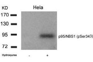 Image no. 1 for anti-Nibrin (NBN) (pSer343) antibody (ABIN196715) (Nibrin 抗体  (pSer343))