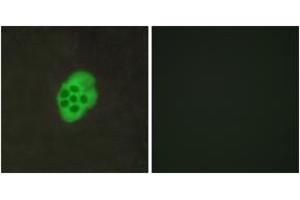 Immunofluorescence analysis of MCF7 cells, using HTR4 Antibody. (Serotonin Receptor 4 抗体  (AA 141-190))