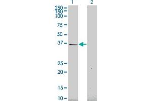 Western Blot analysis of HEY1 expression in transfected 293T cell line by HEY1 monoclonal antibody (M02), clone 2F10. (HEY1 抗体  (AA 121-220))