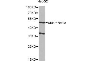 Western blot analysis of extracts of HepG2 cells, using SERPINA10 antibody (ABIN6292722) at 1:1000 dilution. (SERPINA10 抗体)