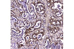 IHC analysis of GDA using anti-GDA antibody . (GDA 抗体  (AA 220-446))