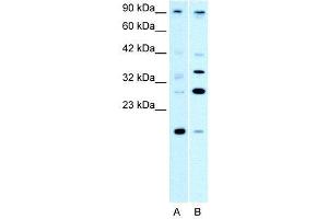 WB Suggested Anti-PARP11  Antibody Titration: 0. (PARP11 抗体  (N-Term))